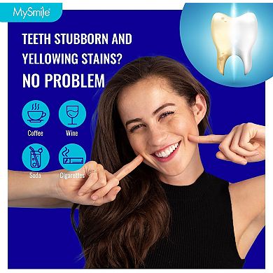 Prefilled Teeth Whitening Trays With 12% Hydrogen Peroxide