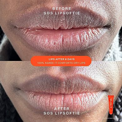 SOS Rescue Bestsellers Kit