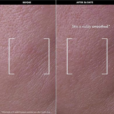 Lift & Firm - Recovery Firming Night Oil with Retinol