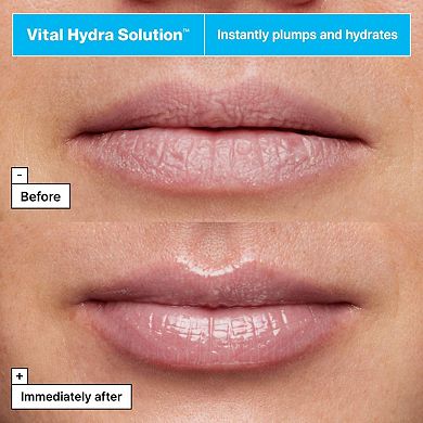 Vital Hydra Solution Jelly Bear Lip Mask with Hyaluronic Acid