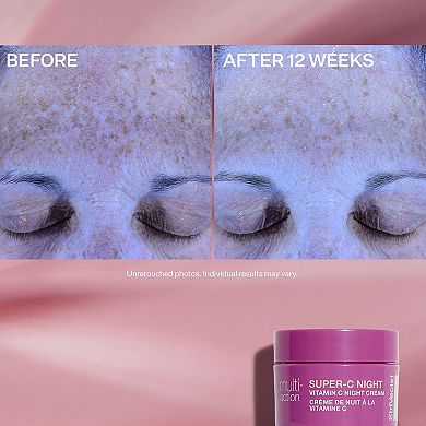 StriVectin Brighten & Restore Kit