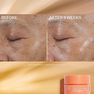 StriVectin Brighten & Restore Kit