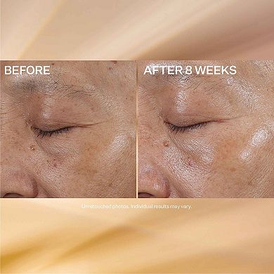 StriVectin Super C Eye Vitamin C Eye Cream
