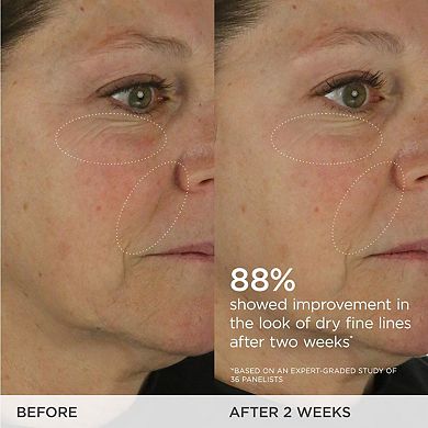 The Dewy Skin Cream Moisturizer Full Size & Refill Pod Bundle