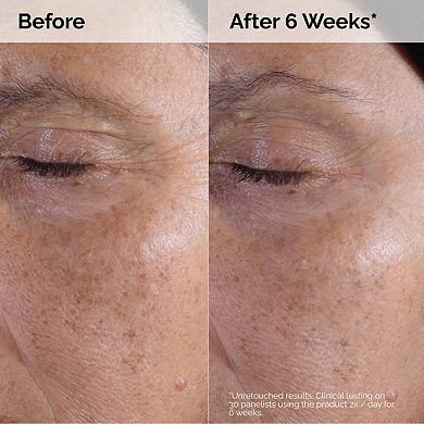 The Glycolic Acid Set