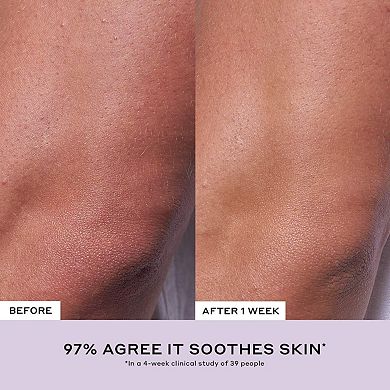 Apres Skin Overnight Moisturizer + Mask with Ceramides and Hyaluronic Acid