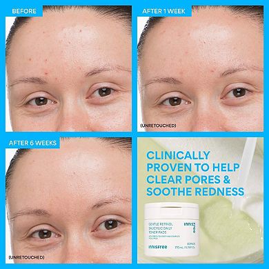 Daily Gentle Retinol Salicylic Toner Pads
