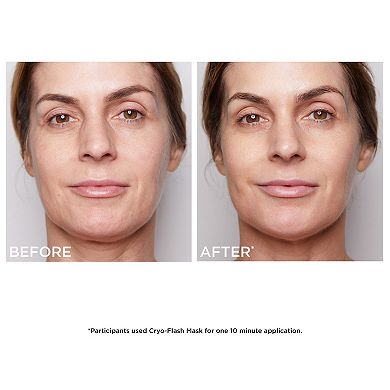 Anti Aging Skincare Essentials Set