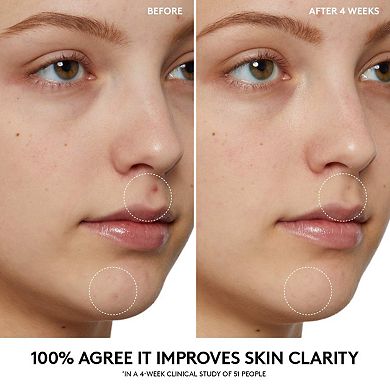 Cherry Dub Pore Purify'r Gel Cleanser