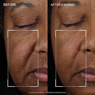 StriVectin Peptight™ Face Lift Serum
