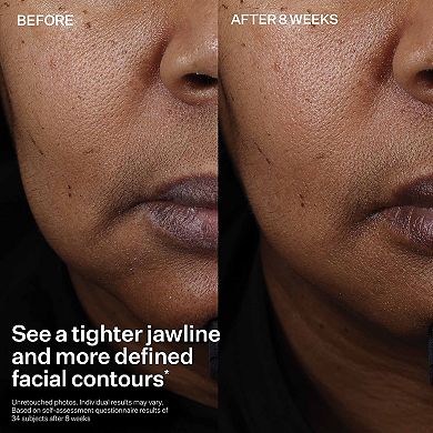 StriVectin Peptight™ Face Lift Serum