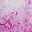 Tie Dye Pink