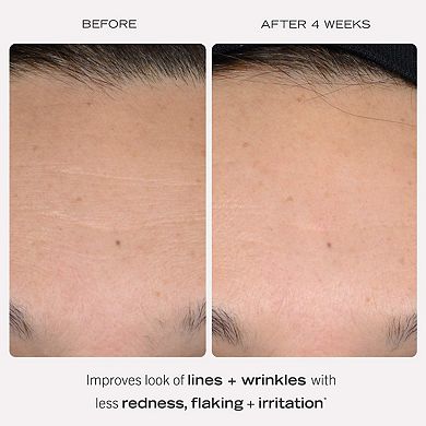 0.3% Retinol Complex Serum with Peptides