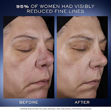 Genifique Ultimate Serum