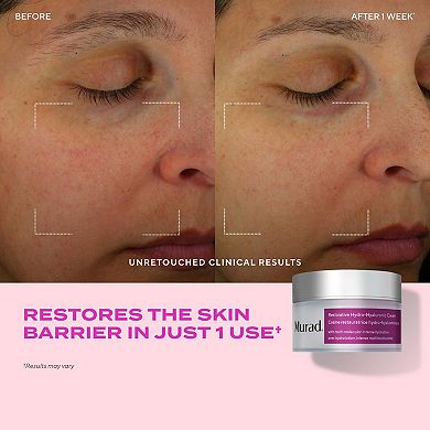 Restorative Hydro Hyaluronic Moisture Cream