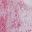 Tie Dye Pink