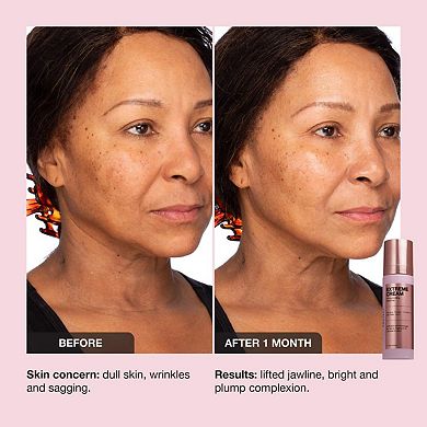 Extreme Cream Anti-Aging, Firming, & Lifting Refillable Moisturizer