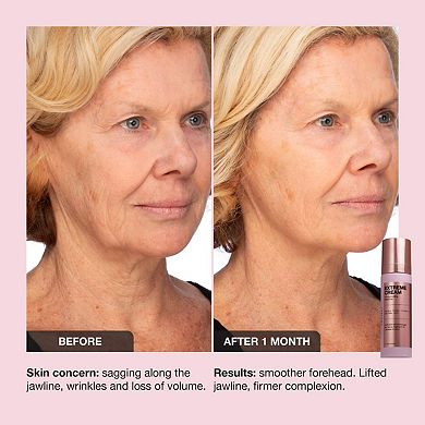 Extreme Cream Anti-Aging, Firming, & Lifting Refillable Moisturizer