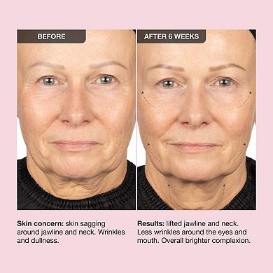 Extreme Cream Anti-Aging, Firming, & Lifting Refillable Moisturizer