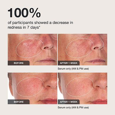 Calm the Red Down Dual Chamber Redness Treatment Serum