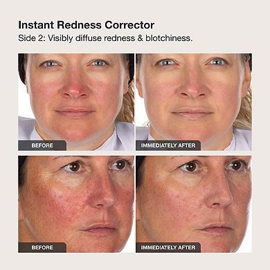 Calm the Red Down Dual Chamber Redness Treatment Serum