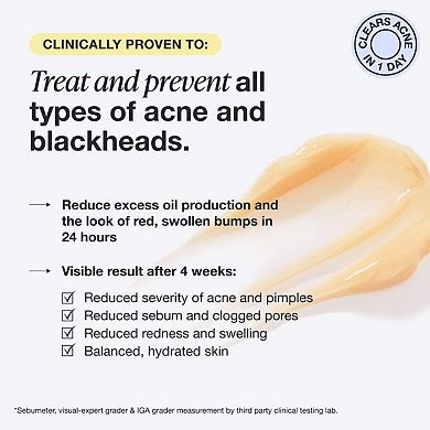 Acne Serum Medicated Treatment for Acne & Blackheads