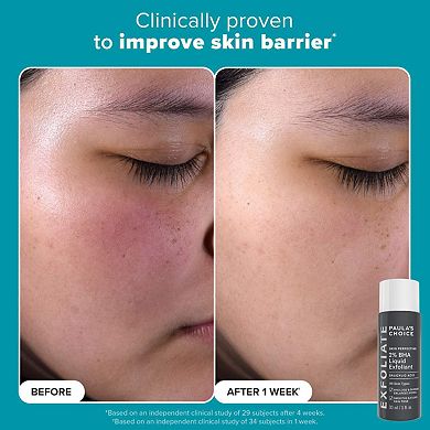 Exfoliation Icons Kit for clear, brighter looking skin