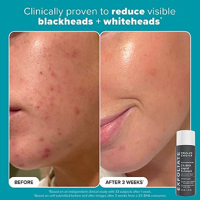 Exfoliation Icons Kit for clear, brighter looking skin