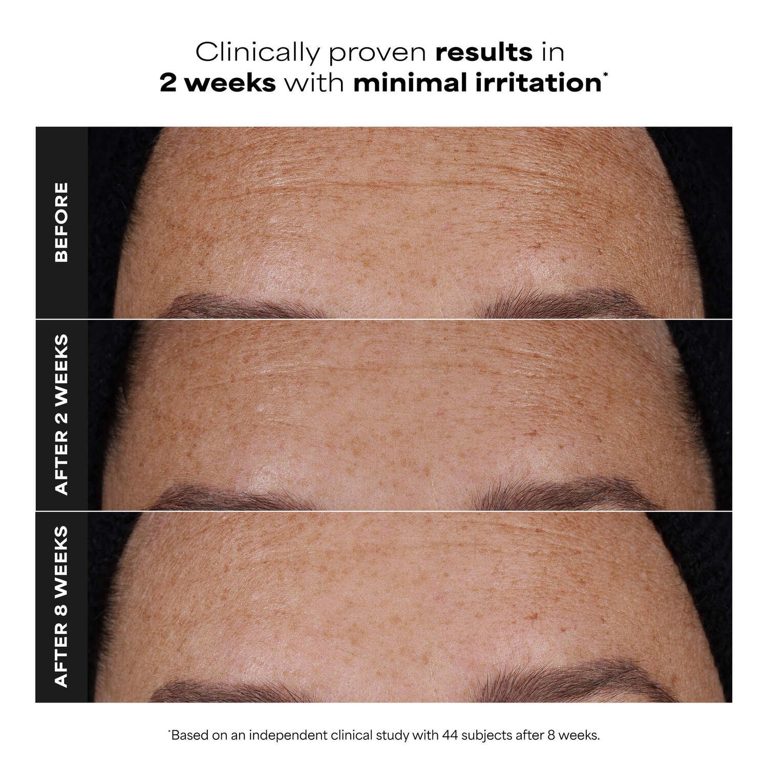 Paula's Choice Clinical PRO Retinaldehyde Dual-Retinoid Treatment for Clear, Luminous Skin