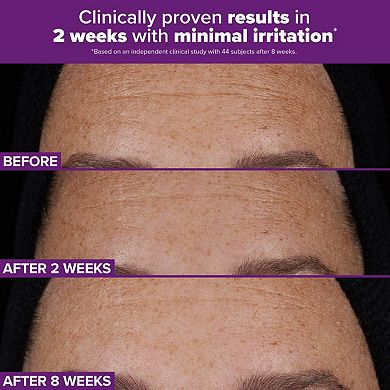 Clinical PRO Retinaldehyde Dual-Retinoid Treatment for Clear, Luminous Skin