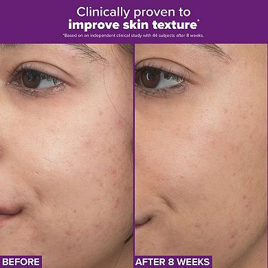 Clinical PRO Retinaldehyde Dual-Retinoid Treatment for Clear, Luminous Skin