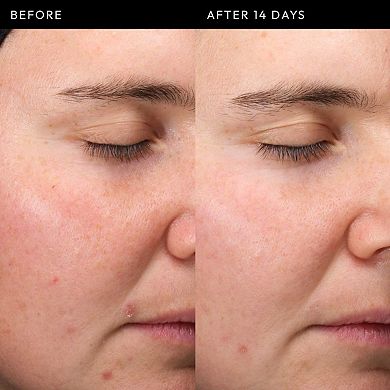 Exosome Hydro-Glow Complex Serum