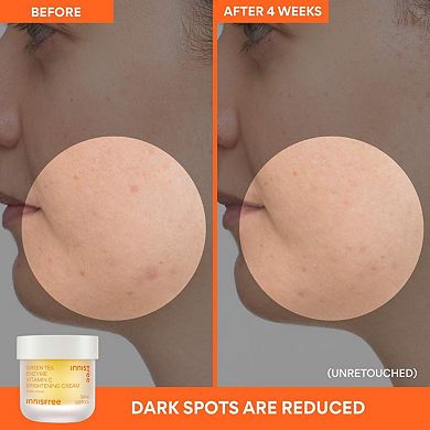 Vitamin C Brightening Refillable Gel Cream Moisturizer for Dark Spots