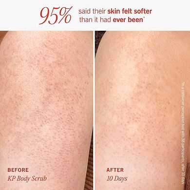 Smooth + Fresh Body Kit Essentials for Every Body