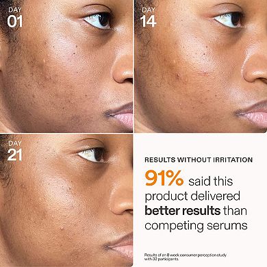 Barrier+ 15% Vitamin C & Ferulic Acid Serum