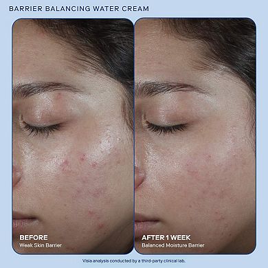 Barrier Balancing Water Cream Moisturizer with Hyaluronic Acid