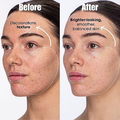 Detox Darling Balancing Essence Mist for Oily and Blemish-prone Skin