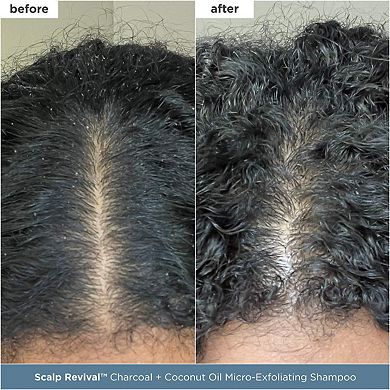 Scalp Revival Moisture + Detox + Refresh Minis Kit for Dry, Flaky Scalp