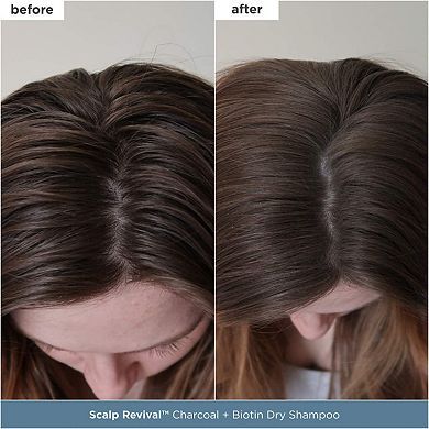 Scalp Revival Moisture + Detox + Refresh Minis Kit for Dry, Flaky Scalp