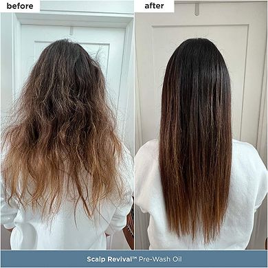 Scalp Revival Moisture + Detox + Refresh Minis Kit for Dry, Flaky Scalp
