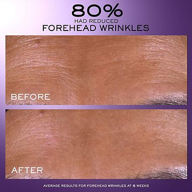 Renergie C.R.X. Triple Serum Retinol