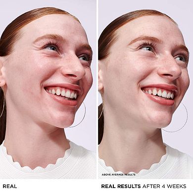 Bye Bye Redness Serum