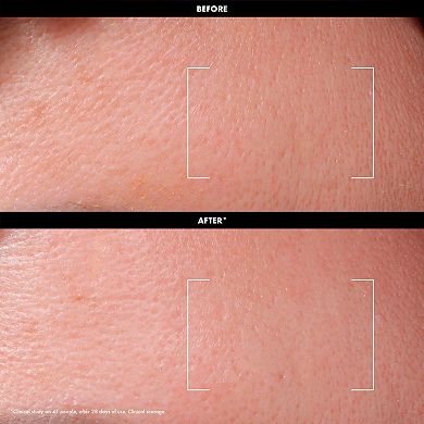 Daily Resurfacing Toner