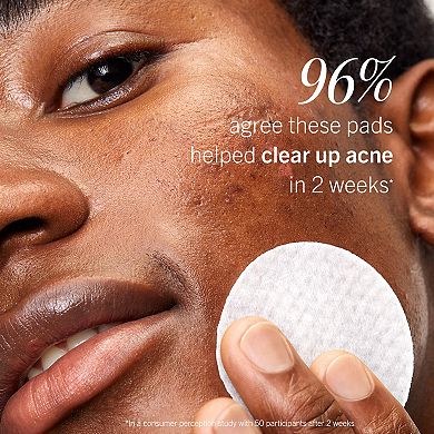 Acne Clearing Pads - 2% Salicylic Acid Acne Treatment