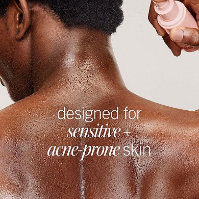 Body Acne Clearing Mist - 2% Salicylic Acid Acne Treatment