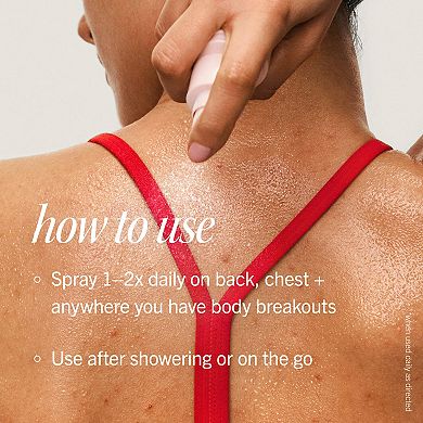 Body Acne Clearing Mist - 2% Salicylic Acid Acne Treatment