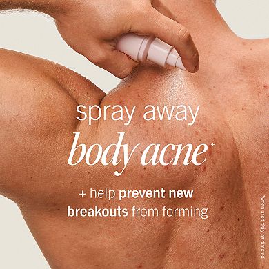 Body Acne Clearing Mist - 2% Salicylic Acid Acne Treatment