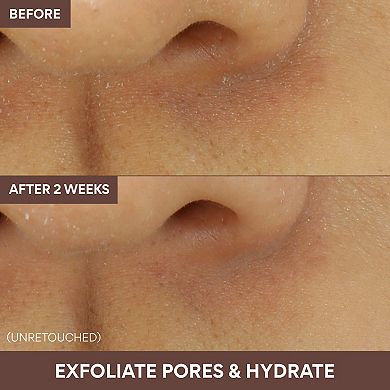 Volcanic Swirl Exfoliating Pore Mask
