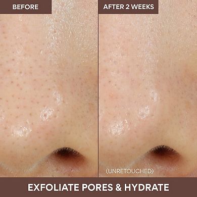 Volcanic Swirl Exfoliating Pore Mask