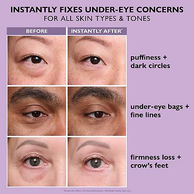 Instant FIRMx Eye Temporary Eye Tightener Easy-Wear Formula for Firming Under-Eye Bags & Wrinkles
